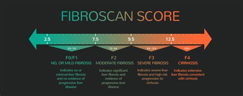 fibroscan score chart|fibroscan score chart hemochromatosis.